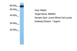 MARK4 Antibody, Novus Biologicals 100 &mu;L | Buy Online | Novus Biologicals | Fisher Scientific